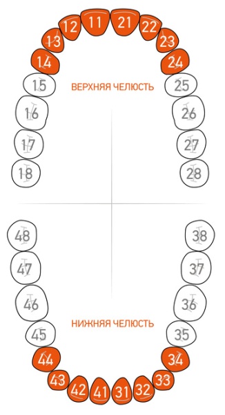 Кламп-сепаратор (Ivory Separator) для центральных зубов Dentech (Япония) 216